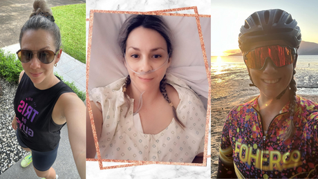 Life After Complex Endometriosis Surgery - Here's What I've Learnt